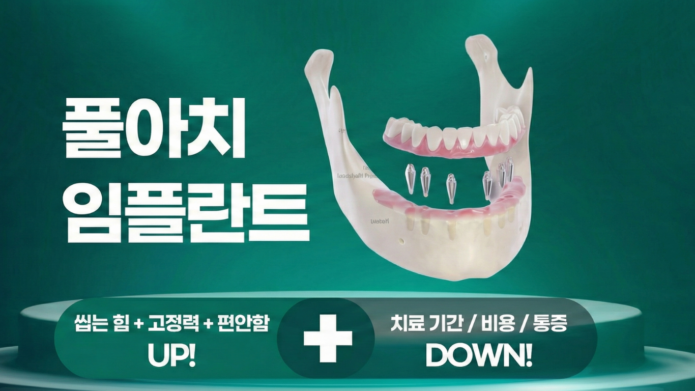 디지털 풀아치 시스템